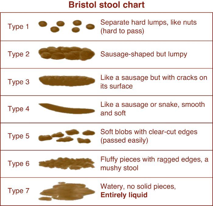 Bristol Stool Chart1